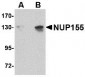 NUP155 Antibody